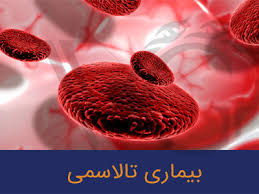 123 بیمار تالاسمی در کردستانی/خدمات رایگان به بیماران تالاسمی