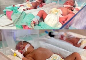 تولد سه‌قلوهای سالم با روش IVF در بیمارستان بعثت سنندج